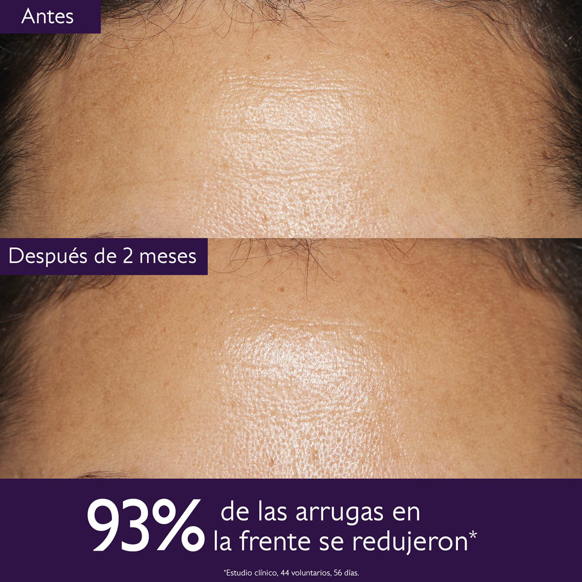 TRÍO ANTI-ENVEJECIMIENTO PARA LÍNEAS DE EXPRESIÓN Y ARRUGAS (SET ANTI-ENVEJECIMIENTO)